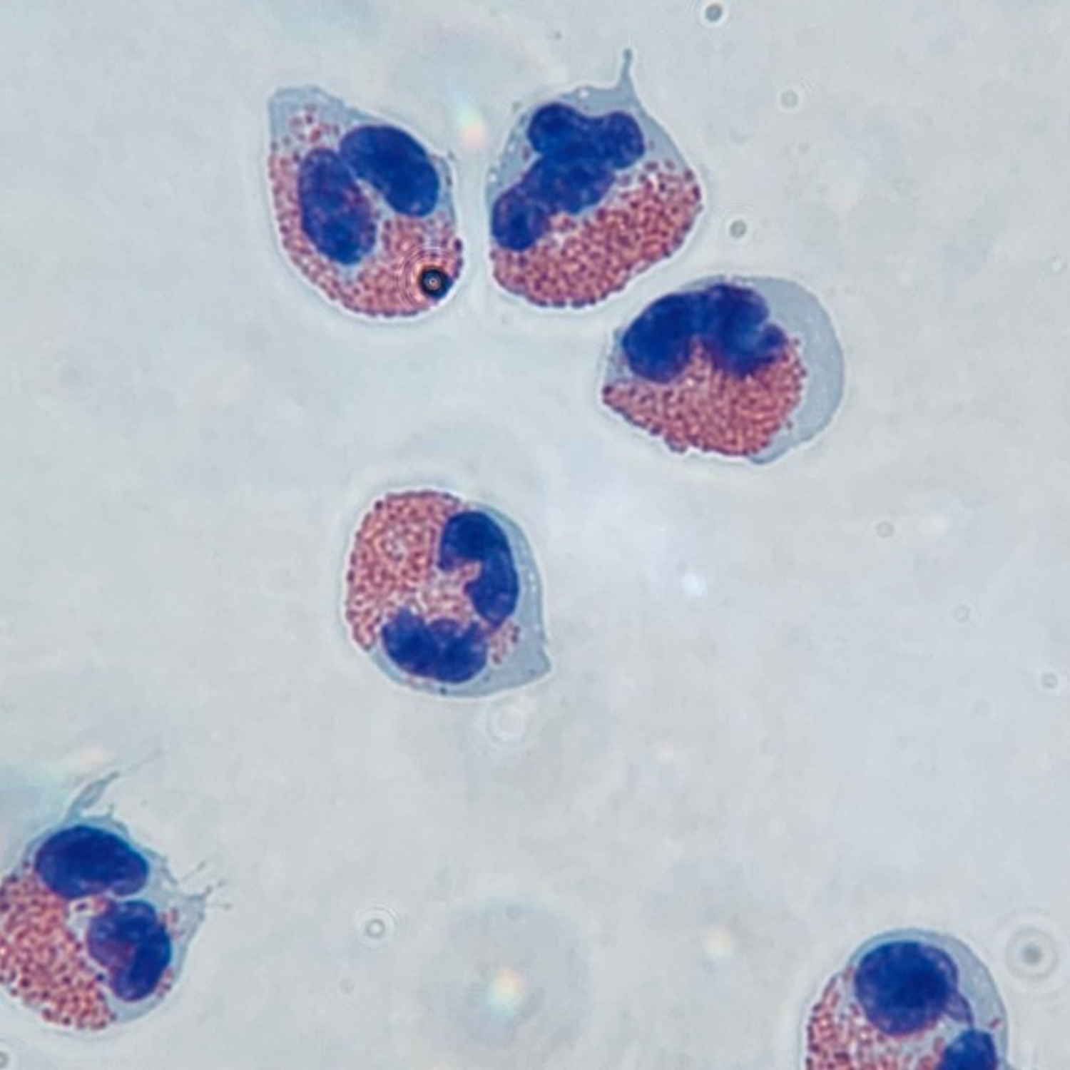 eosinophiles