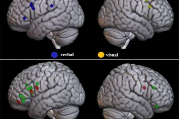 Résister aux interférences visuelles, phonologiques et sémantiques - Processus identiques ou différents ? Un mini-examen ciblé
