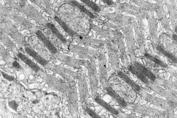 Fibres musculaires : une organisation inattendue