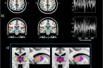 La lumière module la connectivité thalamo-corticale en fonction de la tâche pendant une tâche d'attention auditive