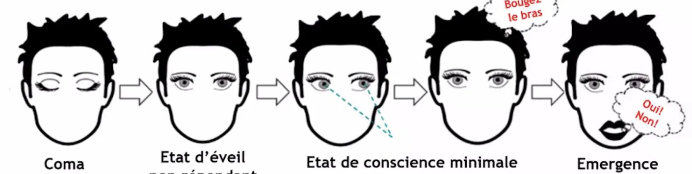 Patients en « état végétatif » : une nouvelle piste pour réussir à évaluer leur niveau de conscience 